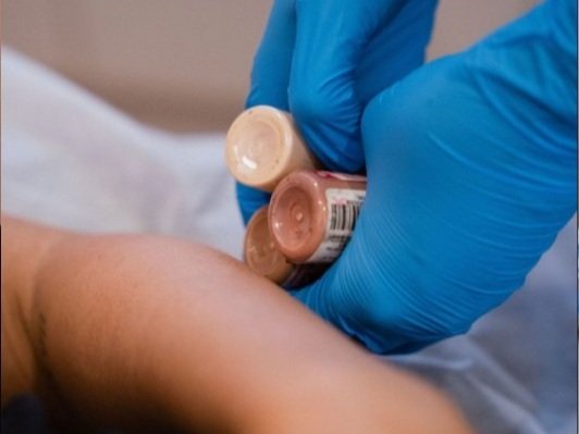 elevate tattoo academy scars arm.jpg